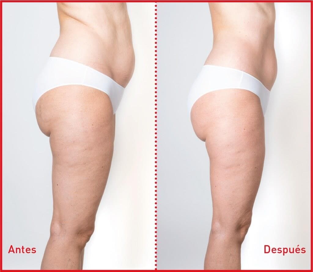 3 PASOS: Cuerpo ideal todo el año - Imagen 2