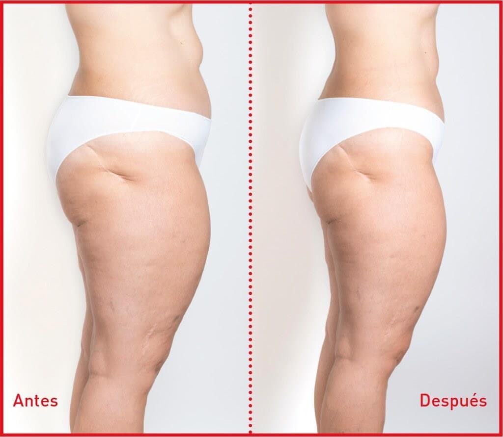 3 PASOS: Cuerpo ideal todo el año - Imagen 3