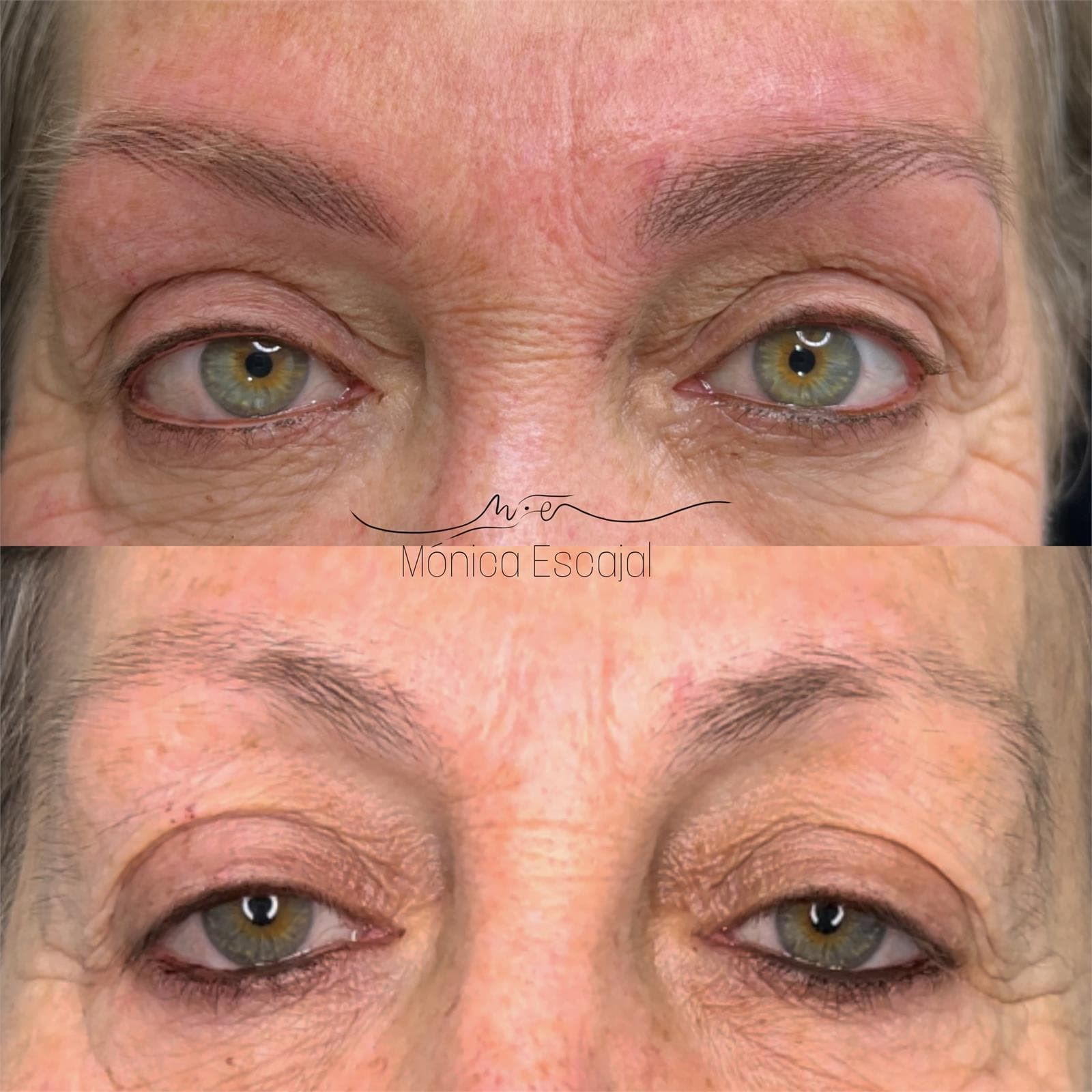 Micropigmentación: 9 enero - Imagen 2