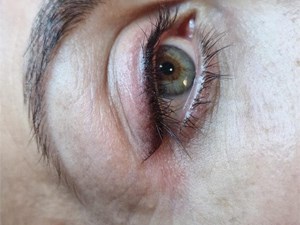 Micropigmentación:  9 enero